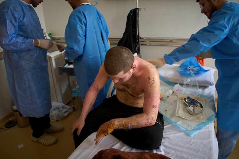 Καμπανάκι του ΠΟΥ για τις συνθήκες στα νοσοκομεία του Λιβάνου